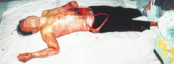 1725590760437230.png 301520.png